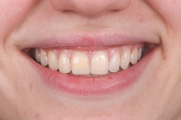 Bilde1.jpg Bilde1.jpg