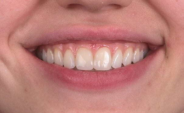 Bilde11.jpg Bilde11.jpg