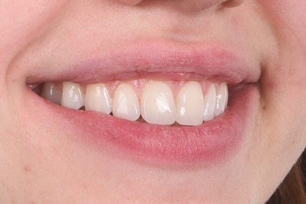 Bilde12.jpg Bilde12.jpg