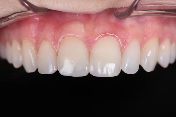 Bilde13.jpg Bilde13.jpg