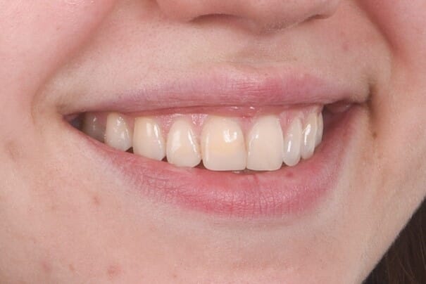 Bilde2.jpg Bilde2.jpg