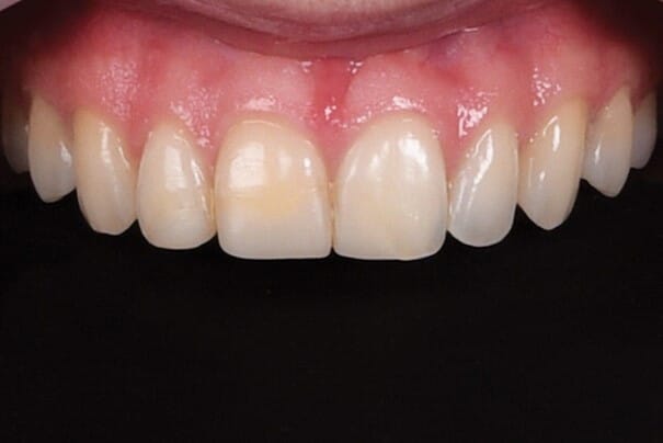 Bilde3.jpg Bilde3.jpg