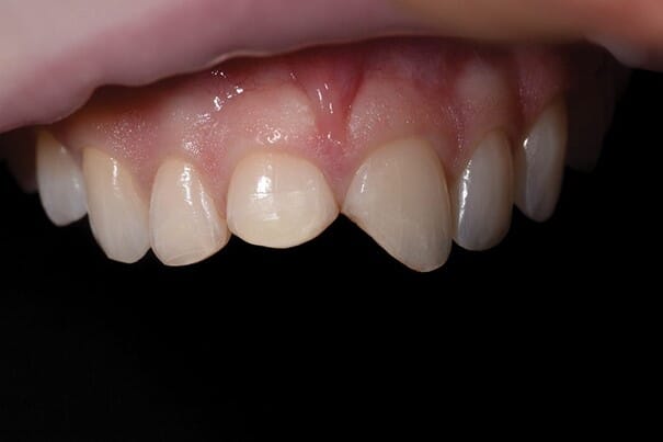 Bilde4.jpg Bilde4.jpg