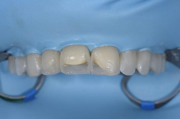 Bilde6.jpg Bilde6.jpg