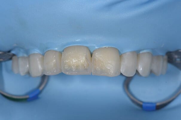 Bilde7.jpg Bilde7.jpg