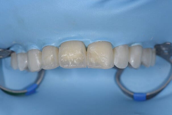 Bilde8.jpg Bilde8.jpg