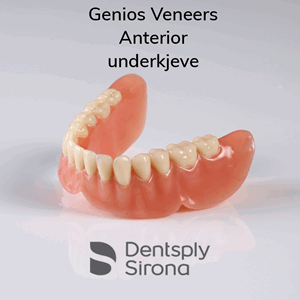 Genios Veneers Anteriors protesetenner 6 stk UK