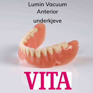 Lumin Vacuum Anterior protesetenner 6 stk UK