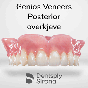 Genios Veneers Posterior protesetenner 6 stk OK