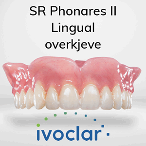 SR Phonares II Lingual protesetenner 8 stk OK